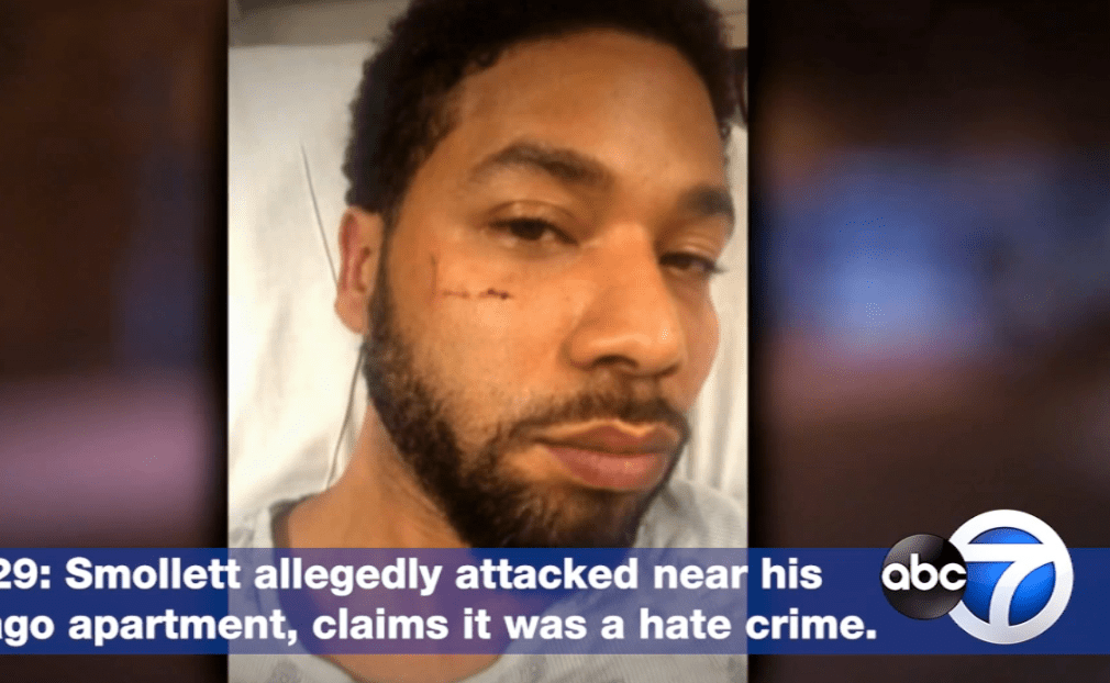 5 POINTS pour comprendre l&rsquo;affaire JUSSIE SMOLLETT&nbsp;!